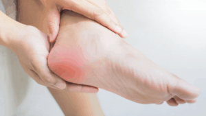 Plantar Fasciitis (Heel Pain) Treatment and Reviews