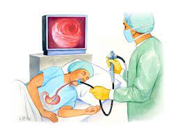 Things to check when receiving a sleep endoscopy for the first time! (Review)